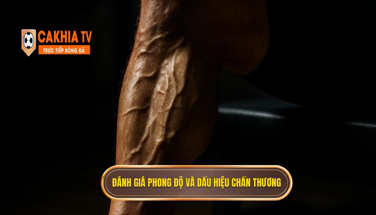 Mẹo chọn kèo Serie A khi xem trực tiếp Cà Khịa: Góc nhìn Chuyên Gia 2 Đánh giá Phong độ Tức thời và Dấu hiệu Chấn thương